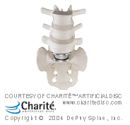 artifical disc