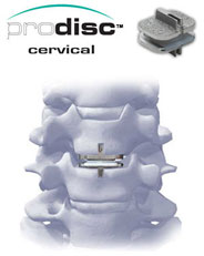 artifical disc