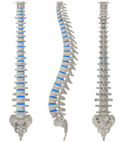 spinal cord injury